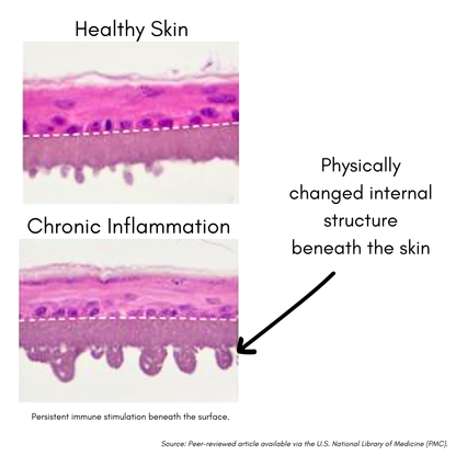 VitaChews™ Itchy Skin Relief Program